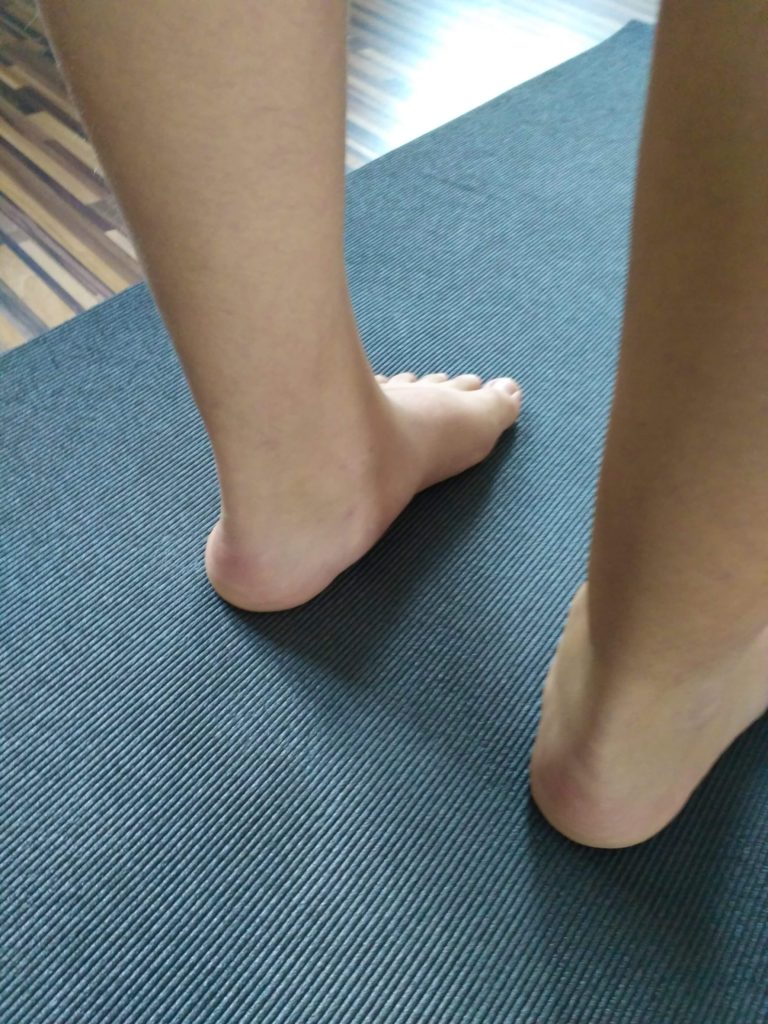 Ploché nohy u dětí